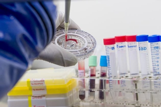 Mỹ xác nhận trường hợp nhiễm virus Ebola đầu tiên